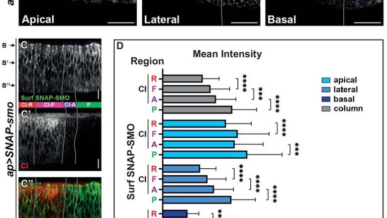 Plessis Lab – High hedgehog signaling is transduced by a multikinase-dependent switch controlling the apico-basal distribution of the GPCR smoothened