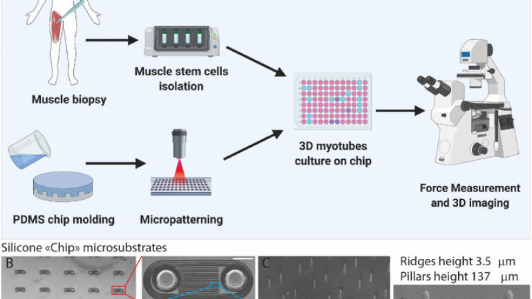 Ladoux/Mège Lab – Bioengineering a miniaturized in vitro 3D myotube contraction monitoring chip to model muscular dystrophies