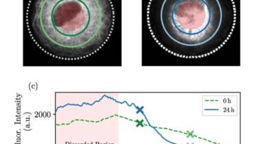 Romet-Lemonne / Jégou Lab – Models of vimentin organization under actin-driven transport