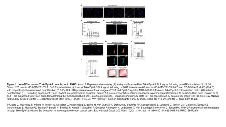 Borghi Lab – ProNGF promotes brain metastasis through TrkA/EphA2 induced Src activation in triple negative breast cancer cells